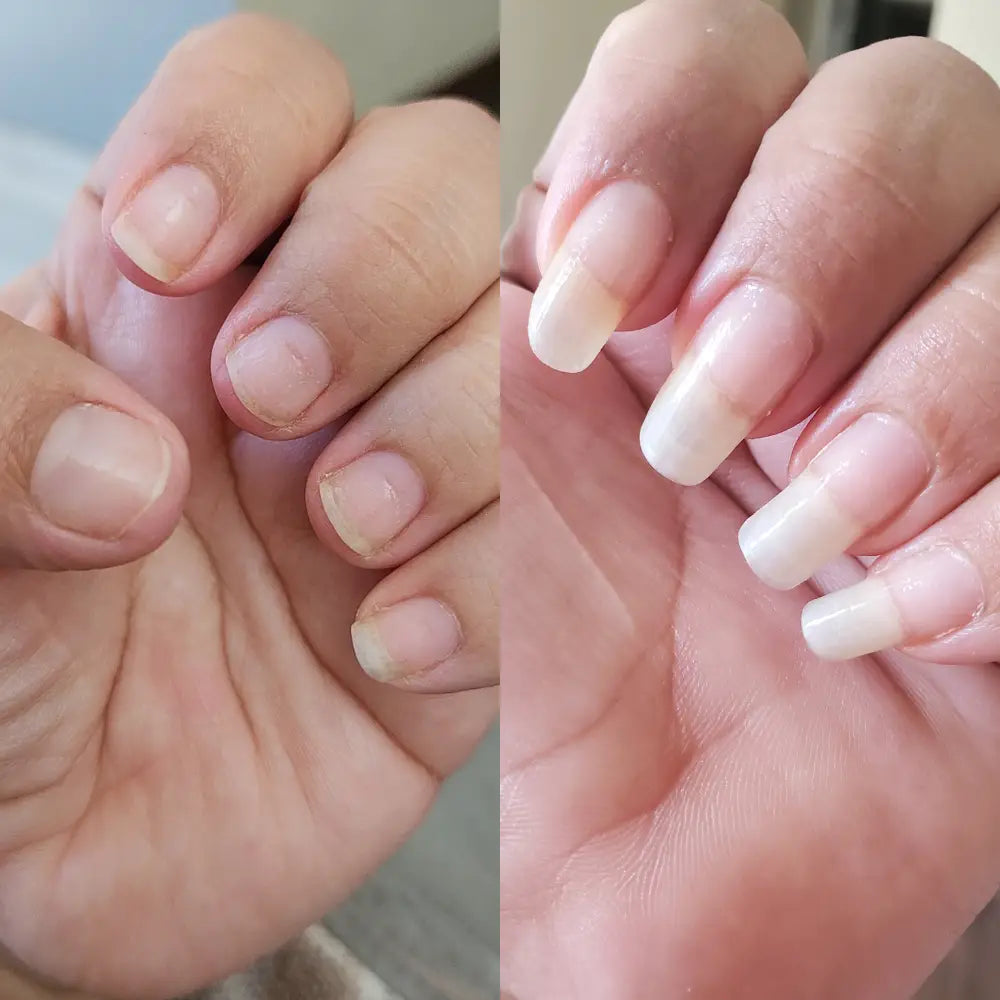 Glowy Bloom™ Stem Cells Nail Growth Pen